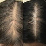 Anti Hair Fall Oil | Anti Hair Loss Oil | Onest