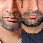 Anti Hair Fall Oil | Anti Hair Loss Oil | Onest