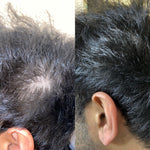 Anti Hair Fall Oil | Anti Hair Loss Oil | Onest